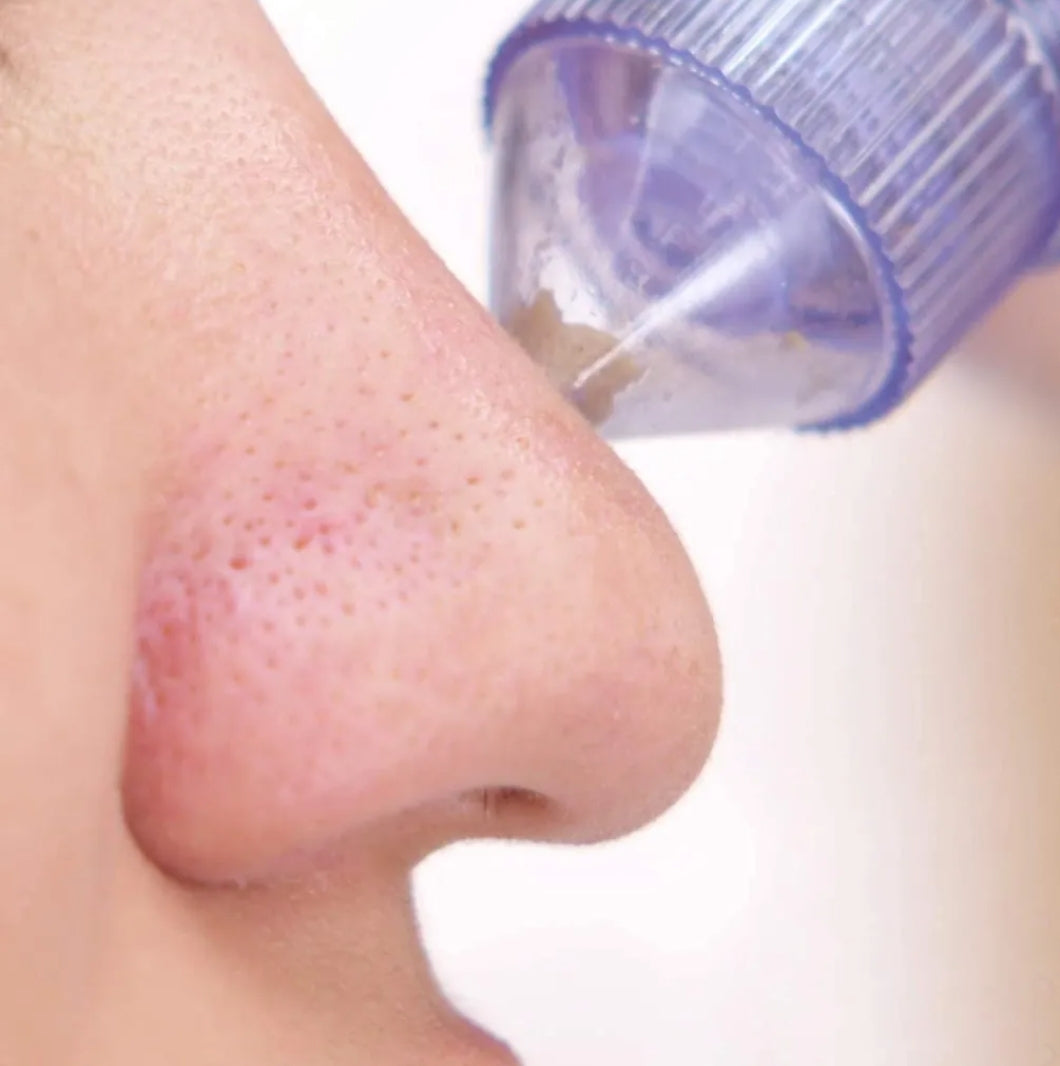 Blackhead Remove /Anti Acne/Wrinkle / Derma Suction tool