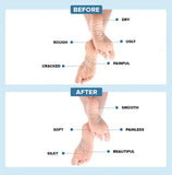 Cracked Heel repair gel socks